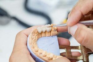 dentist explaining dental bridges to patient using a model