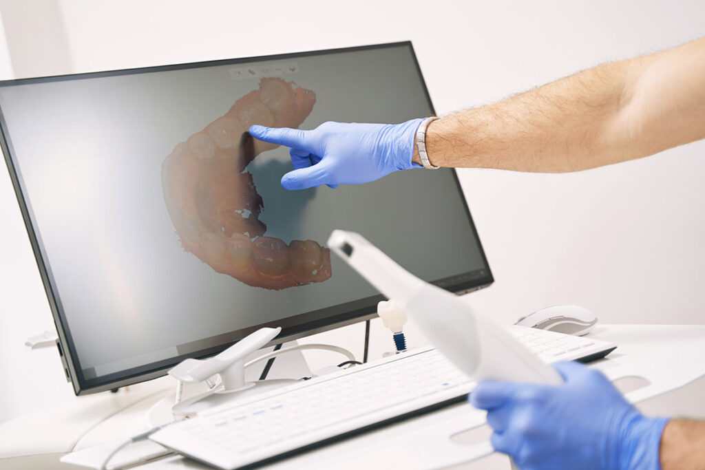 Hands of a person explaining the benefits of a digital intraoral scanner to a patient