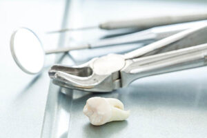 tools for tooth extractions and an extracted tooth