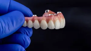 dentist holding implant overdentures to show how long do implant overdentures last