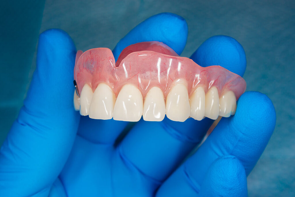 dental professional holding model of dentures while explaining the evolution of dentures