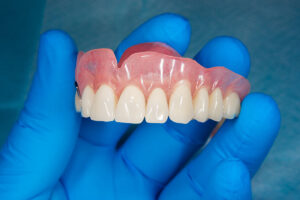 dental professional holding model of dentures while explaining the evolution of dentures