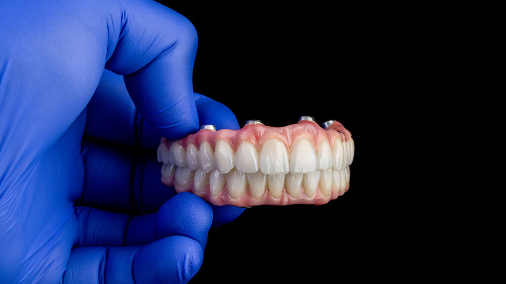 dental professional wearing gloves holding pair of dentures while giving a second opinion for dental implants