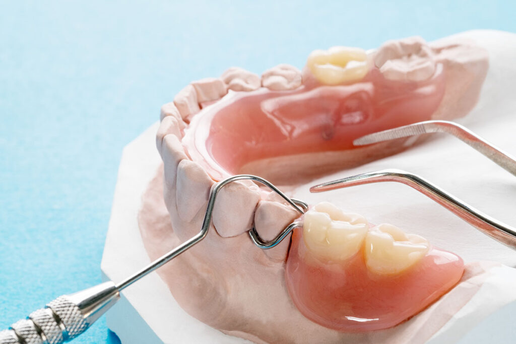 close up of dental prosthetic to show removable partial denture care