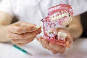 dentist showing model of teeth to a candidate for dental implants