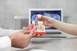Dentist explaining a dental implant model to a patient, with a tooth X-ray visible on a laptop in the background.